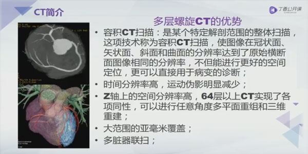 丁香园 手把手教你读懂腹部CT